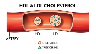 Định lượng cholesterol toàn phần máu thấp