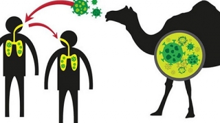 Virus MERS là gì? Triệu chứng của virus MERS như thế nào?