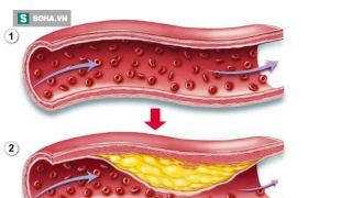 Mỗi ngày ăn 1 món để mạch máu thông suốt, trẻ hóa kỳ diệu