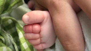 Sợi tóc của mẹ thít chặt vào chân, bé 10 tuần tuổi suýt phải cắt cụt 4 ngón