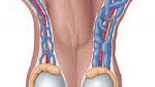 Giãn tĩnh mạch thừng tinh ở nam giới có nguy hiểm?