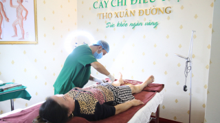 Tìm hiểu phương pháp cấy chỉ chữa bệnh và thẩm mỹ