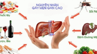 Nên làm gì khi men gan cao?