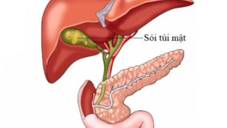 Điểm mặt nguyên nhân gây đau bụng ở người cao tuổi