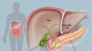 Nguyên nhân gây ra ung thư tuyến tụy và tại sao tỷ lệ sống sót lại thấp như vậy?