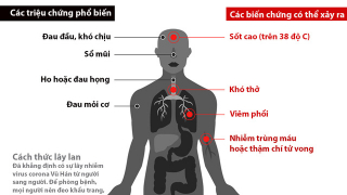Triệu chứng phổ biến ở người nhiễm SARS-CoV-2 tại Việt Nam