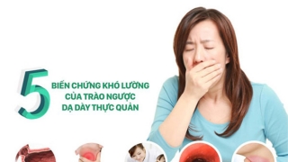 Làm gì khi bị trào ngược axit và đầy hơi? Các chuyên gia cho rằng bạn nên ăn ít những thực phẩm sau