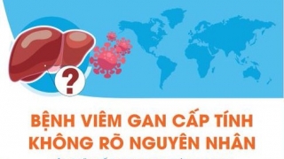 Infographic: Thông tin cần biết về bệnh viêm gan cấp tính chưa rõ nguyên nhân