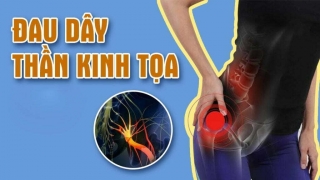 Địa chỉ tin cậy khám bệnh đau dây thần kinh tọa