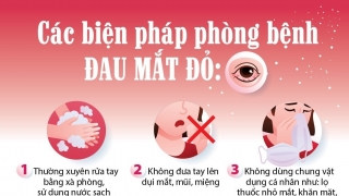 Bệnh đau mắt đỏ đang gia tăng, cần làm gì để phòng bệnh?