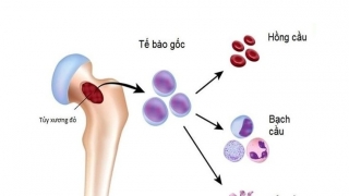 Tế bào gốc tạo máu là gì? Ứng dụng của tế bào gốc tạo máu trong điều trị bệnh