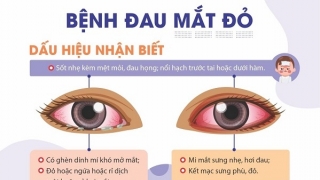 Cà Mau ghi nhận trên 17.700 ca bệnh đau mắt đỏ