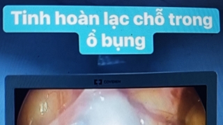 Nghệ An: Bệnh viện Đa khoa 115 phẫu thuật thành công bệnh nhân có tinh hoàn nằm trong ổ bụng