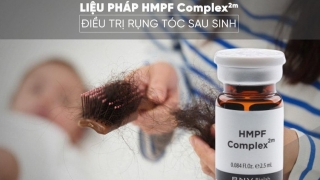 Liệu pháp HMPFComplex2m – Liệu pháp điều trị rụng tóc sau sinh