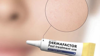 Quản lý sẹo hiệu quả hơn bao giờ hết với Dermafactor