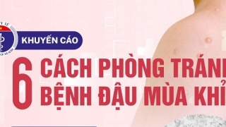 Cà Mau tăng cường phòng, chống bệnh đậu mùa khỉ