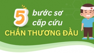 Infographic: 5 bước sơ cấp cứu chấn thương đầu