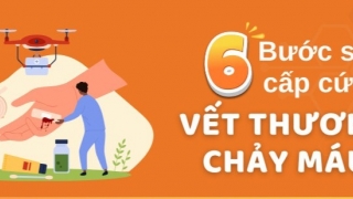 Infographic: 6 bước sơ cấp cứu vết thương chảy máu