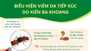 Biểu hiện viêm da tiếp xúc do kiến ba khoang