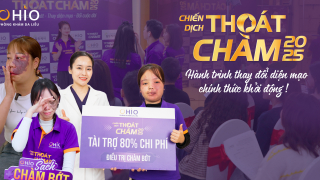 Chiến dịch “Thoát Chàm 2025” bước vào giai đoạn điều trị – Cuộc hành trình thay đổi diện mạo chính thức khởi động