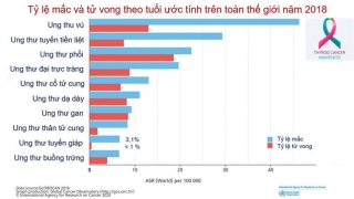 Bác sĩ BV Bạch Mai chỉ ra 5 điều quan trọng về dấu hiệu để phát hiện ung thư tuyết giáp