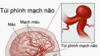 Ăn thịt chó rước 3 nguy cơ bệnh tật kinh người mà bạn không biết