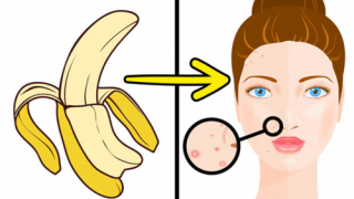 8 mẹo làm đẹp từ vỏ chuối