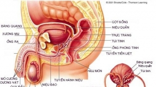 Ung thư tiền liệt tuyến giai đoạn đầu có biểu hiện gì không