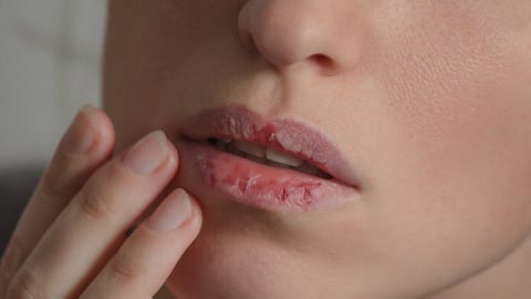 Dấu hiệu da bị “over skincare”: Chăm quá kỹ gây hại