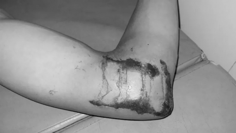 Lạng Sơn: Hy hữu trường hợp nam thanh niên bị sét đánh ngất ngay trong phòng ngủ