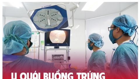 Phú Thọ: Phẫu thuật nội soi cắt khối chửa ngoài tử cung và u quái buồng trứng cho nữ bệnh nhân 36 tuổi