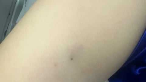 TP. Hồ Chí Minh: Cấp cứu thành công bệnh nhi 3 tuổi bị sốc phản vệ do ong ruồi đốt