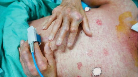 Quảng Ninh: Tự ý mua thuốc Nam về uống, người đàn ông đối mặt với hội chứng nguy hiểm