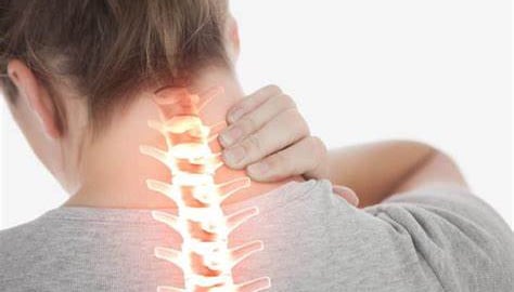 Làm việc sai tư thế, chàng trai 26 tuổi bị mất đường cong sinh lý cổ