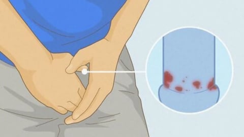 Vì sao nam giới cần tiêm HPV?