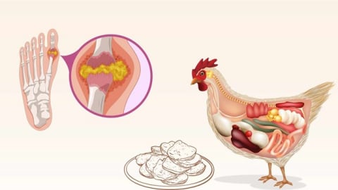 Lý do người có axit uric cao không nên ăn mề gà