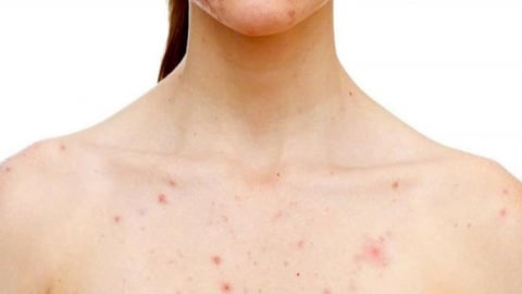 Detox thải độc gan: Hiệu quả thật hay chỉ là trào lưu?