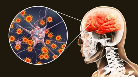 Viêm não Nhật Bản: Những điều cần biết và lưu ý