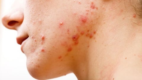 5 dấu hiệu cho thấy cơ thể “quá tải” chất dinh dưỡng