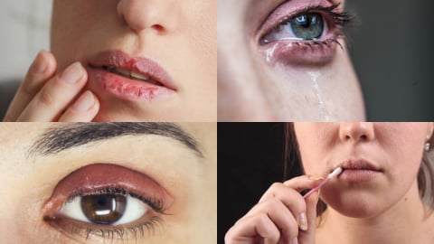 Phun xăm môi, mắt: Cảnh báo những biến chứng không thể xem nhẹ