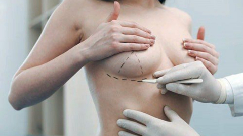 Nâng ngực an toàn: Bạn cần chuẩn bị gì?