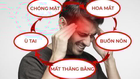 Rối loạn tiền đình: Dấu hiệu sớm và cách tự điều trị tại nhà