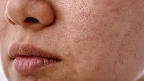 Tuyệt chiêu giữ da khỏe đẹp trong mùa du lịch