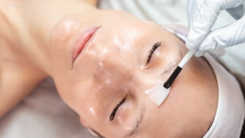 Trị mụn ẩn bằng peel da: Hiểu rõ trước khi thử