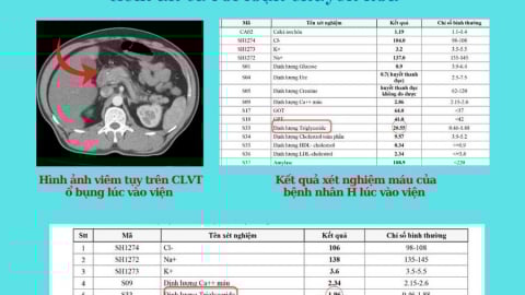 Phú Thọ: Viêm tụy cấp do tăng mỡ máu, nguy cơ tiềm ẩn từ rối loạn chuyển hóa