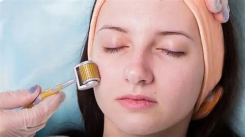 Những điều bạn cần biết về phương pháp lăn kim