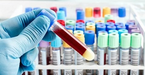 Chế tạo thành công sợi huyết giàu tiểu cầu đông khô