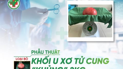 Nghệ An: Bệnh viện Đa khoa thành phố Vinh phẫu thuật loại bỏ khối u xơ tử cung nặng 2kg