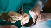 Nghệ An: Phẫu thuật nội soi cấp cứu kịp thời trường hợp bệnh nhân thai ngoài tử cung đoạn kẽ phải