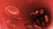Dấu hiệu và nguy cơ hình thành cục máu đông phổ biến